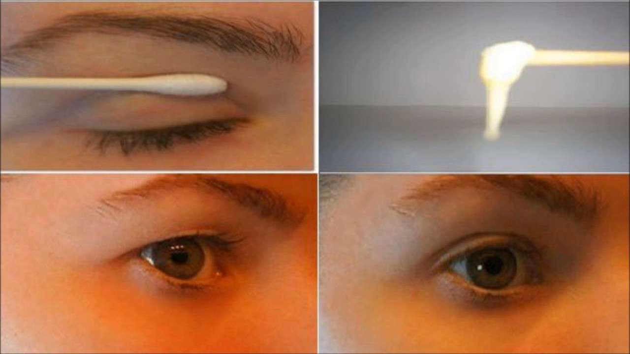 Spadnuté viečka si môžete sami napraviť pomocou jednoduchého receptu