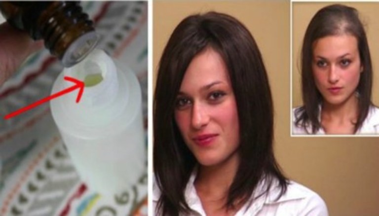 Pridala si do šampónu toto a zabudla, čo je to vypadávanie vlasov. Dnes to každému odporúča