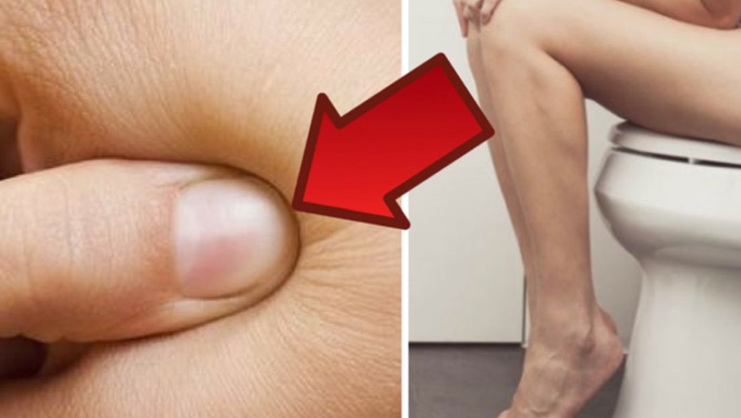 Keď vás začne trápiť zápcha, zabudnite na preháňadlá. Stlačte tento bod s pohybom na vašom tele a črevá sa vyprázdnia