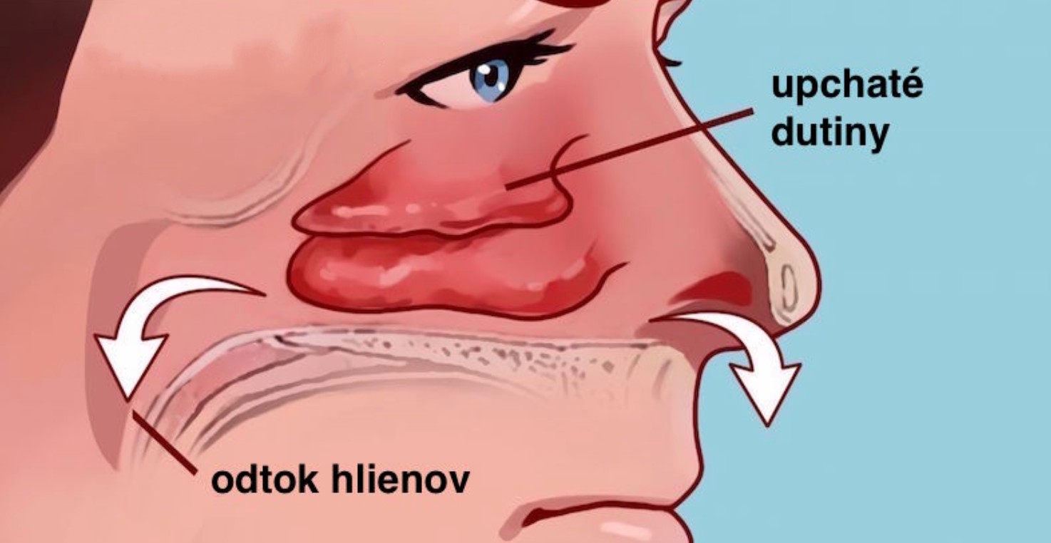 Ako uvoľniť upchaté dutiny len pomocou vašich prstov