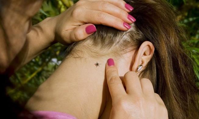 Jednoduchý trik, vďaka ktorému budete mať od kliešťov pokoj počas celého leta! Moja dcérka ich už niekoľko rokov nemala