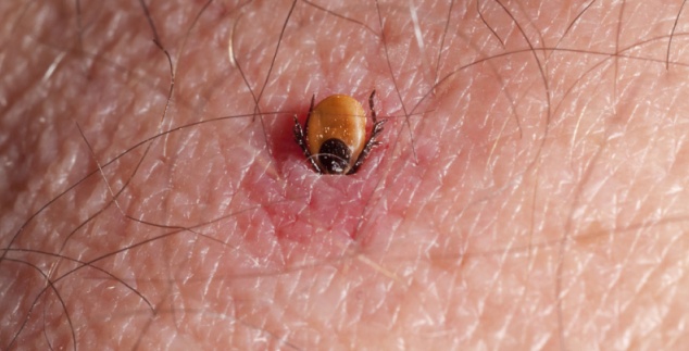 Na rýchle odstránenie kliešťa vám stačí jedna jediná vec, ktorú máme každý doma. Toto sa v lete bude hodiť každému