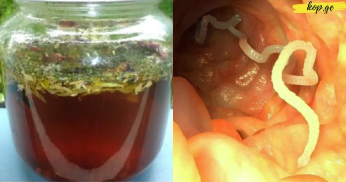 zbavit tělo parazitů