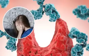 Skrytá daň neustáleho vychádzania ľuďom v ústrety: ako potláčanie emócií môže spustiť autoimunitné ochorenie