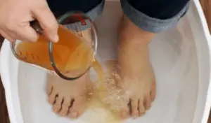 Namočte si nohy do octu na 30 minút. Starý domáci trik, ktorý poznali už naše babičky
