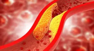 Orechy, ktoré zahanbujú farmaceutické lieky: Jedna dávka zníži cholesterol až na 30 dní